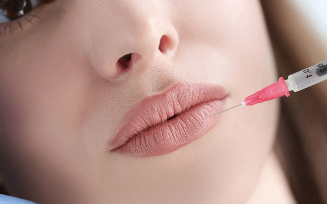 Kada osmijeh izgubi mekoću: kako bore oko usana utječu na samopouzdanje